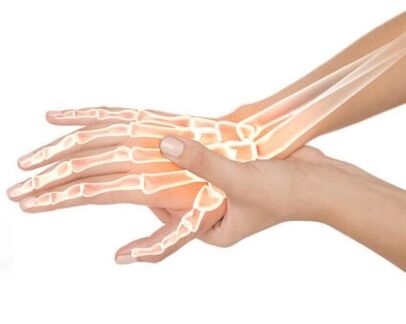 Hondrox aplícase á zona afectada