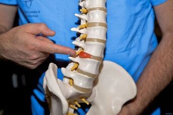 Por que me doe a parte traseira das costas e o que hai que facer