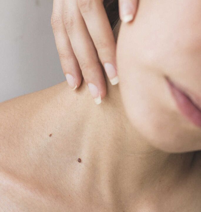 A rixidez no pescozo é un dos síntomas nas fases iniciais da osteocondrose da columna cervical