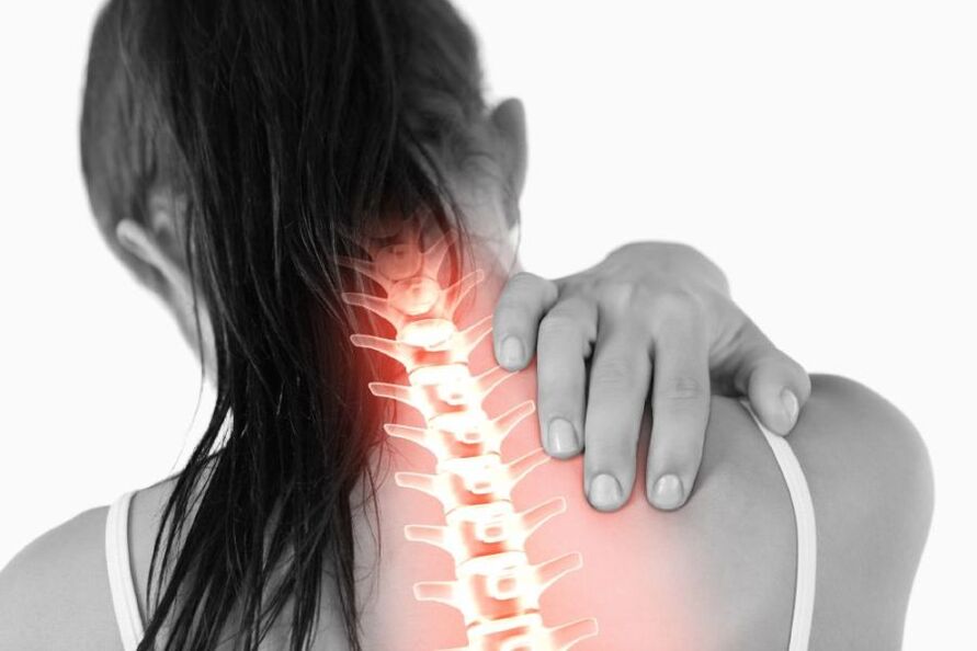 Osteocondrose síntomas