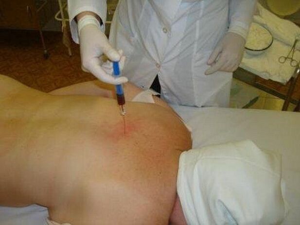 Fármacos para a osteocondrose