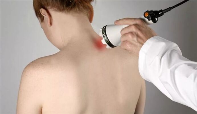 Fisioterapia para o tratamento da osteocondrose cervical